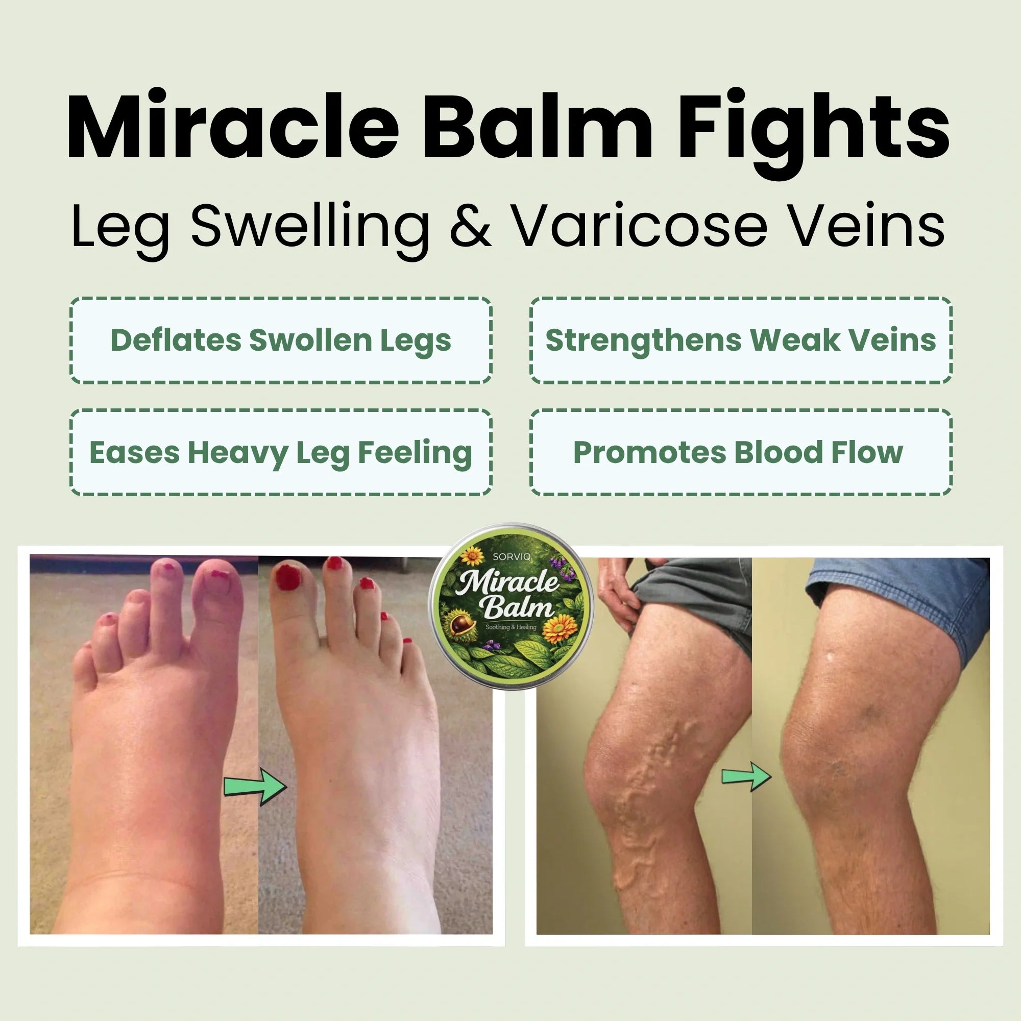 Lymphina Miracle Balm™