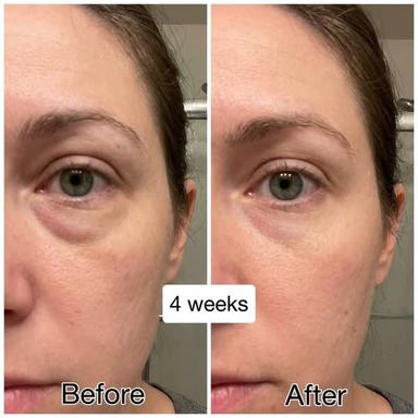 Lymphina Wellness Drops